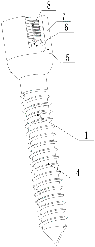 Screw reinforcing fixing device for osteoporotic patient
