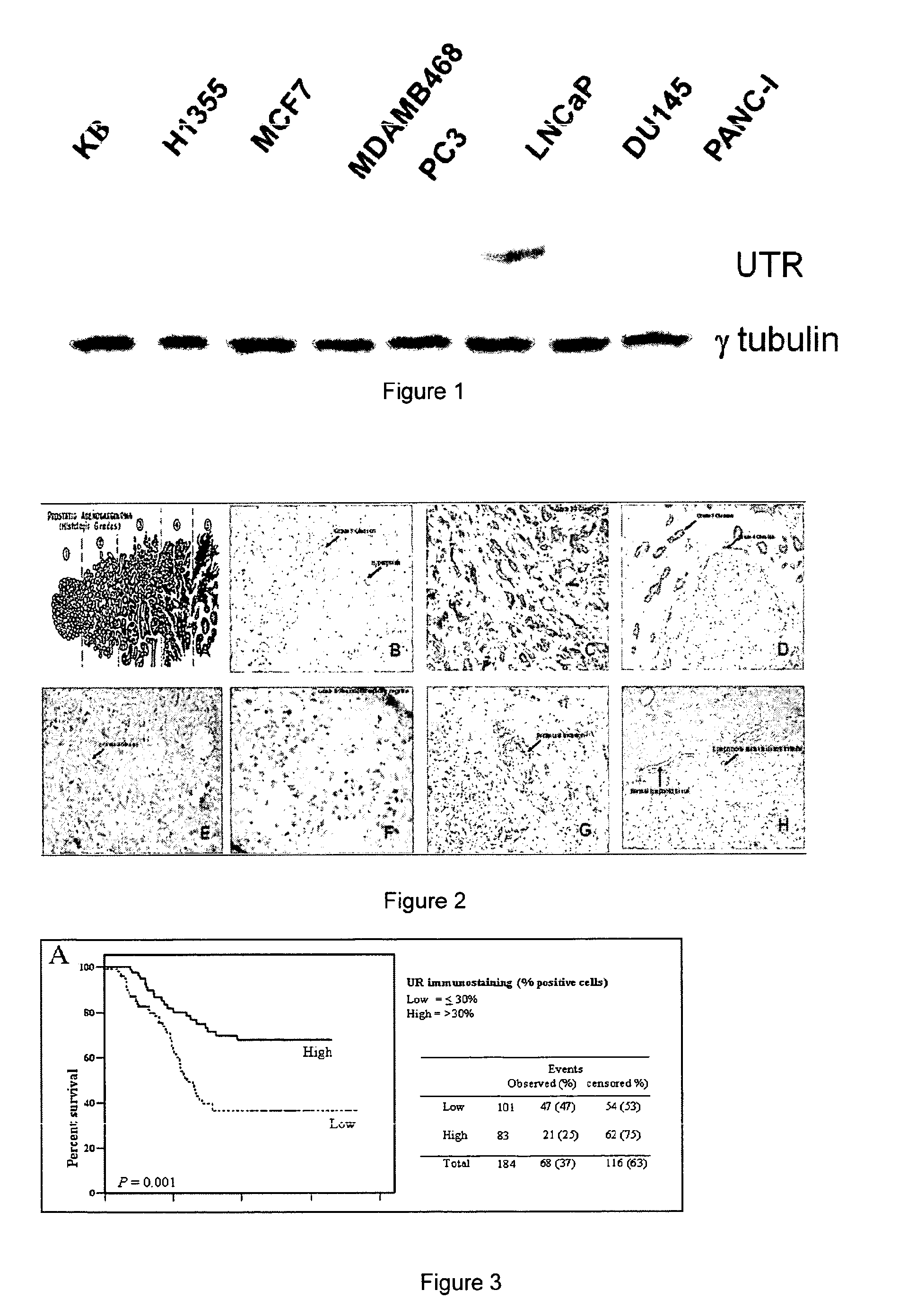 Peptidic and non peptidic ligands for immunodetection of the receptor for urotensin