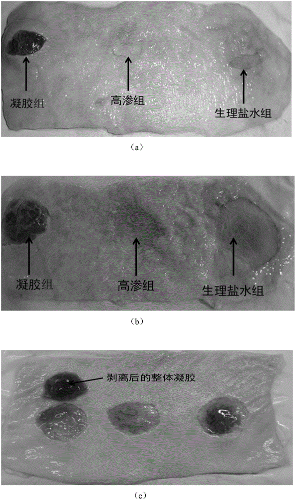 Thermosensitive hydrogel and preparation method and application thereof