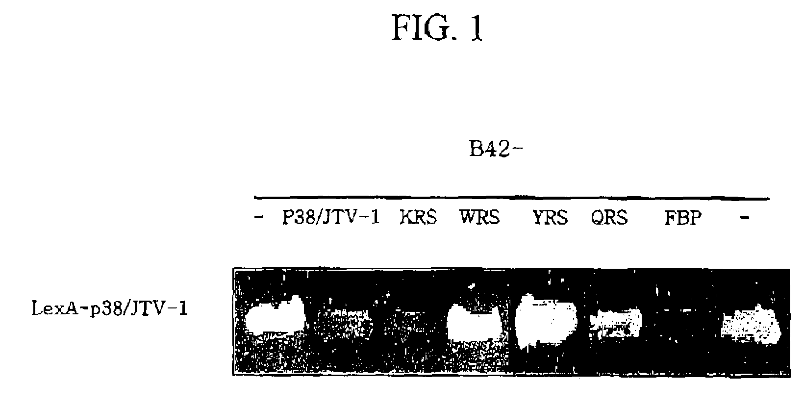 Method for treating cancer using p38/JTV-1 and method for screening pharmaceutical composition for treating cancer