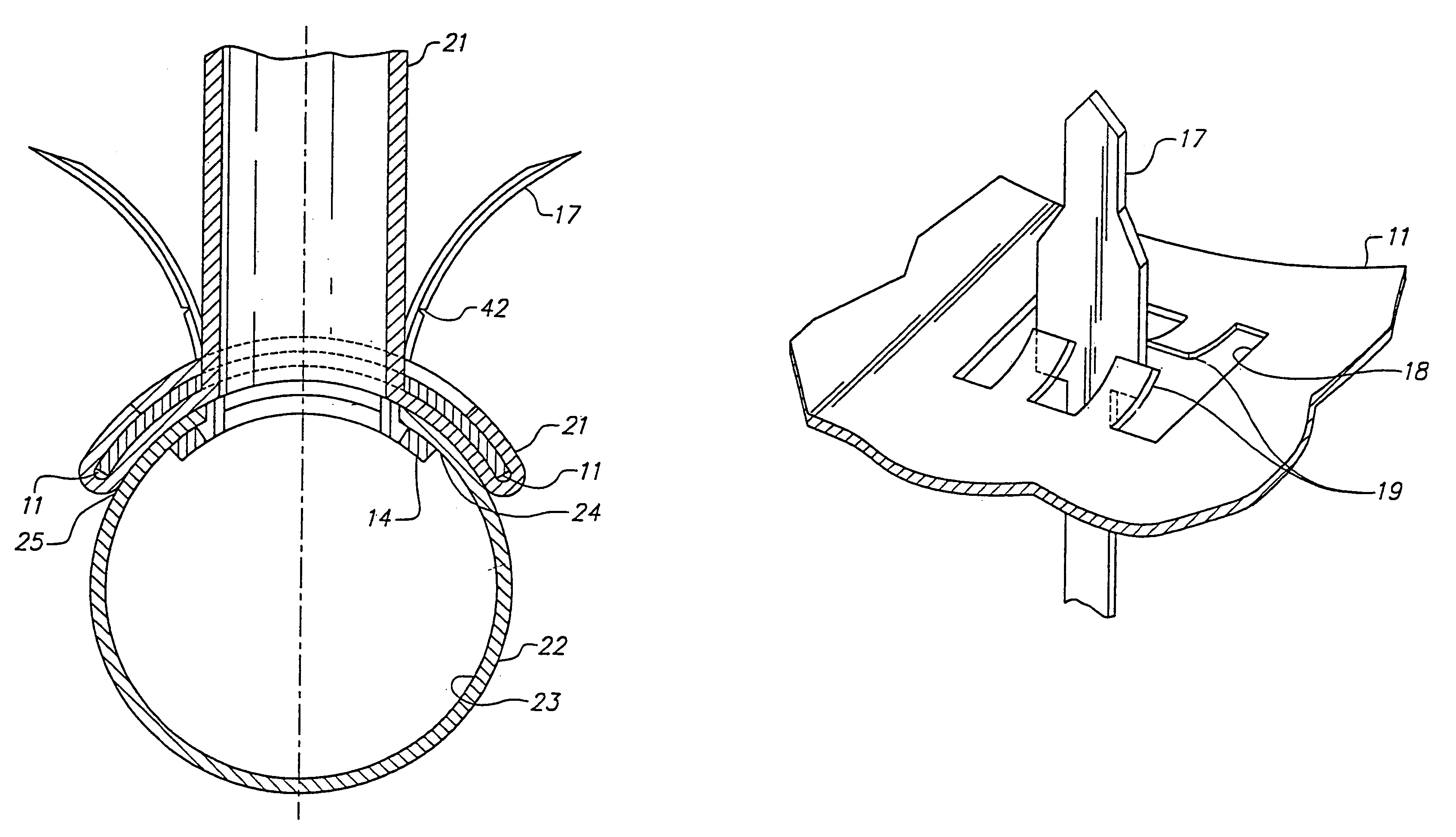 Anastomosis device having at least one frangible member