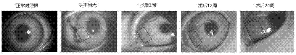 Acellular dermal matrix and preparation method and application thereof