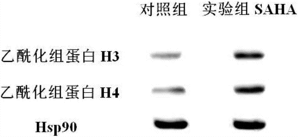 Application of histone deacetylase and inhibitor thereof to preparation of tumor whole cell antigen loaded DC (dendritic cell) tumor vaccine