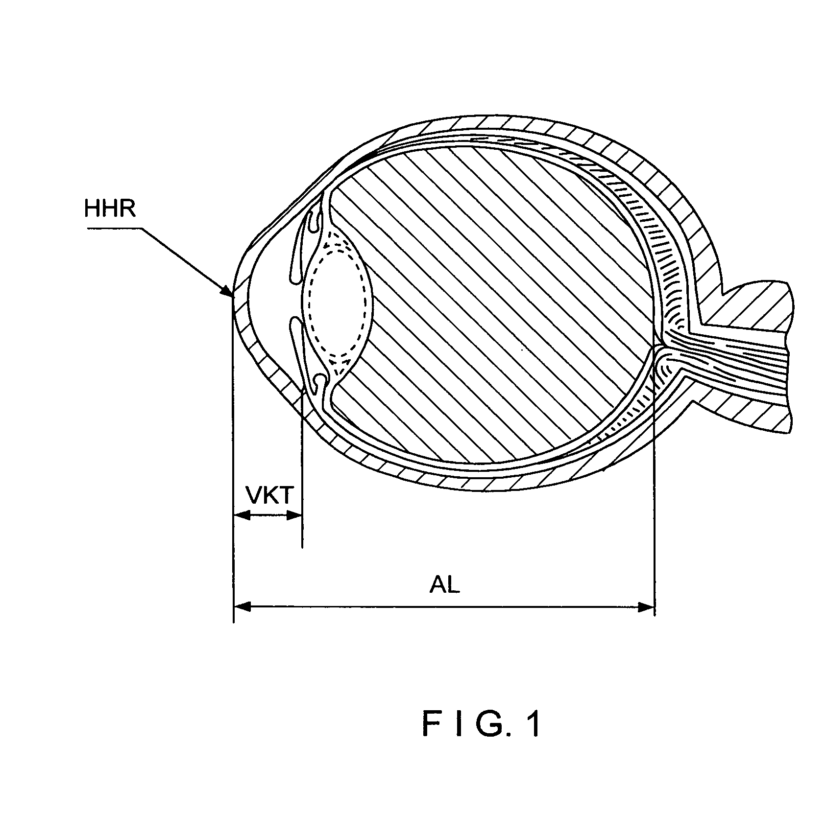 System and method for the non-contacting measurement of the axis length and/or cornea curvature and/or anterior chamber depth of the eye, preferably for intraocular lens calculation