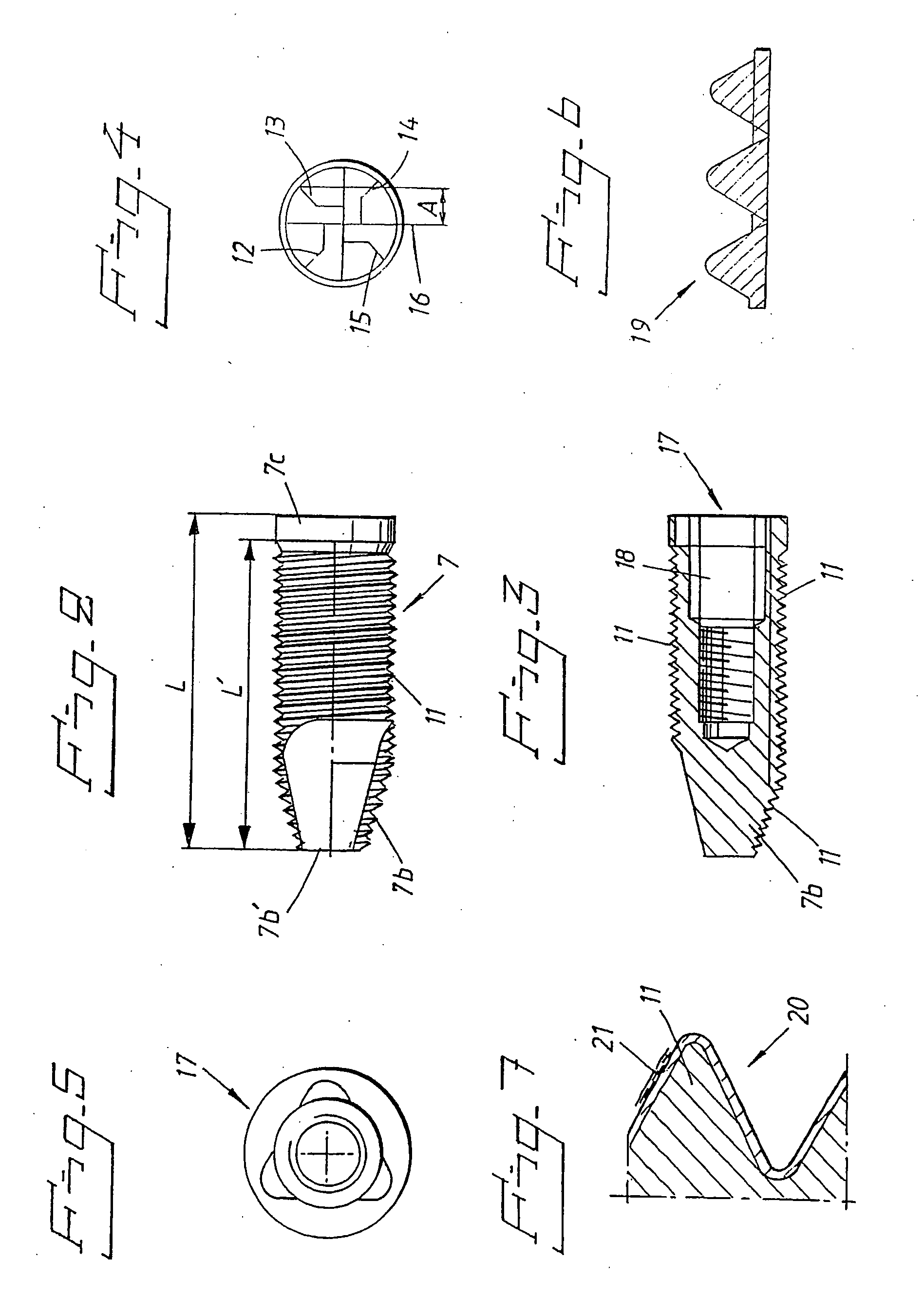 Fixture for anchoring in jaw bone