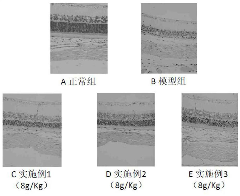 Medicine and food dual-purpose composition capable of resisting blue light damage to retina, and preparation method and application of composition