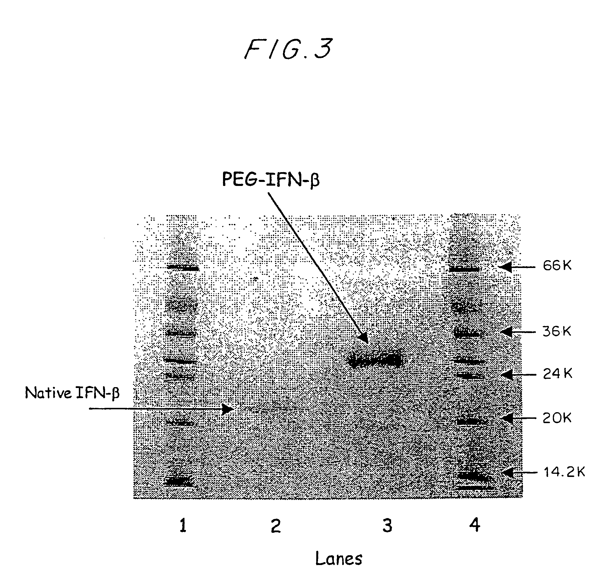 Method for treating disorders and diseases treatable with human fibroblast interferon