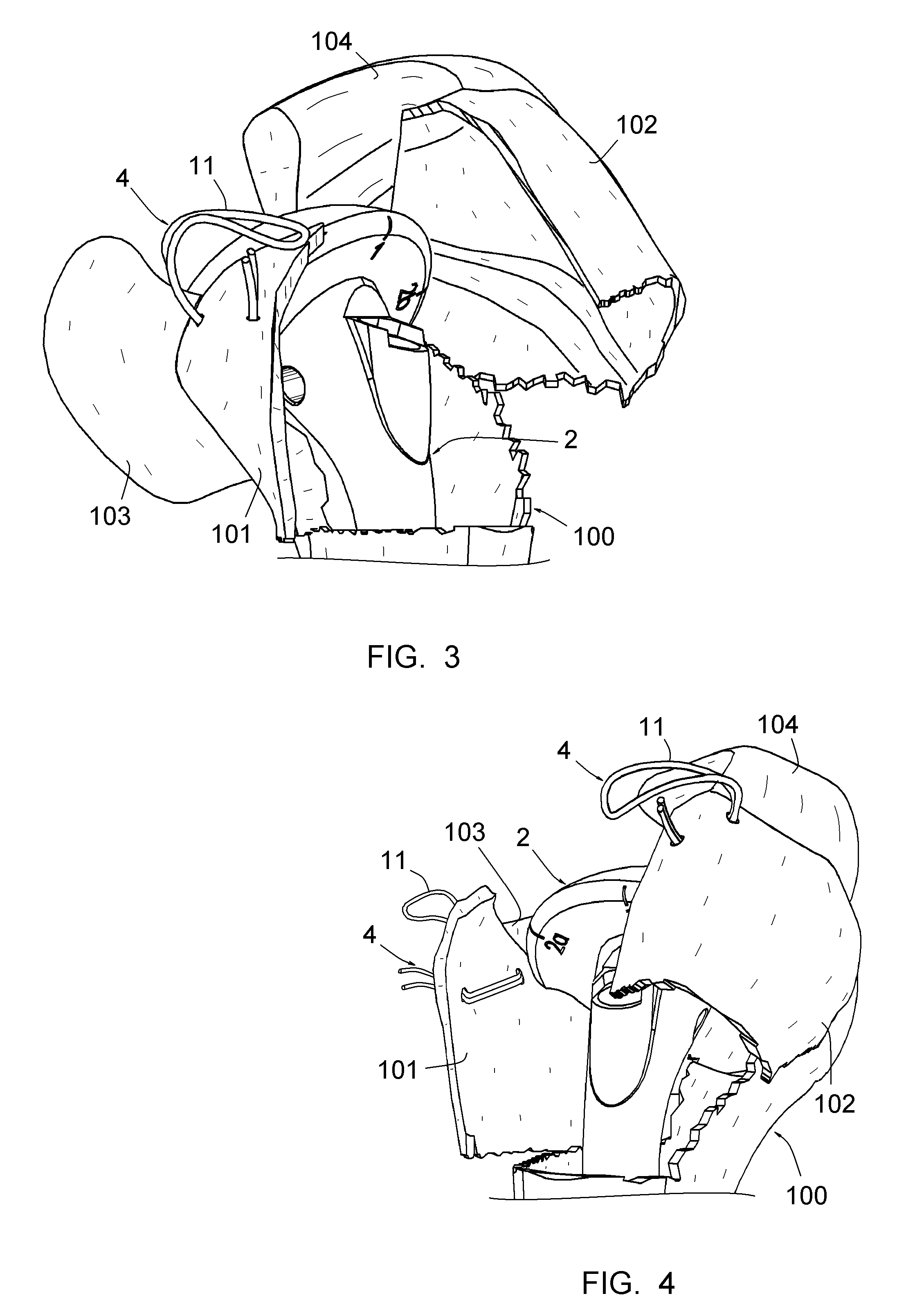 Surgical method for repairing a fractured shoulder joint