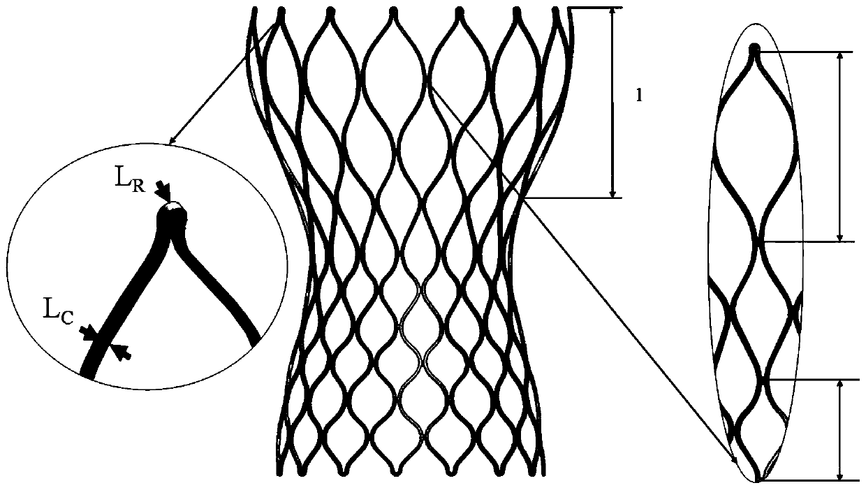 Artificial interventional aortic valve stent with radial support force variation