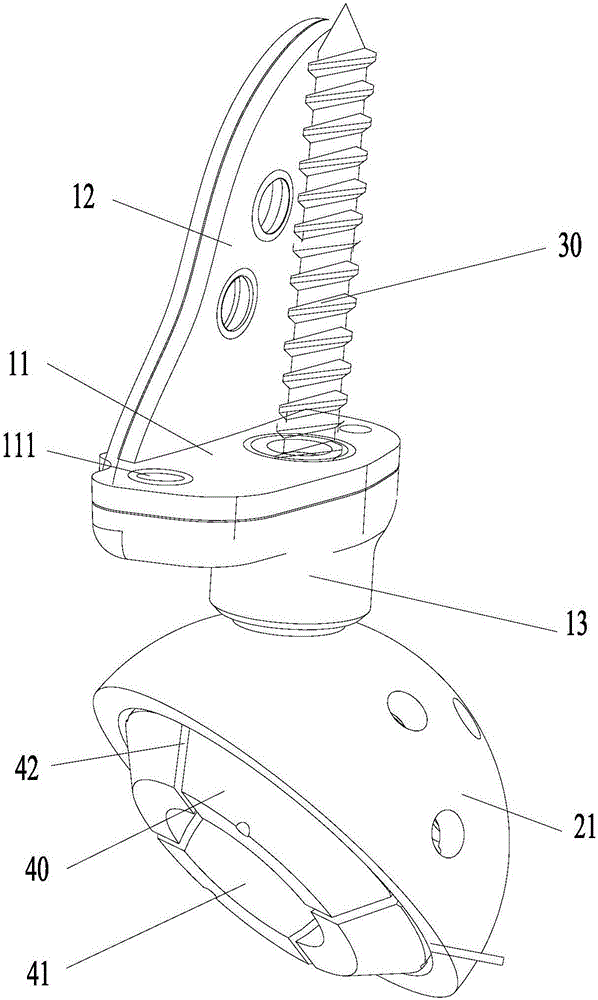 Acetabular defect reconstructive prosthesis