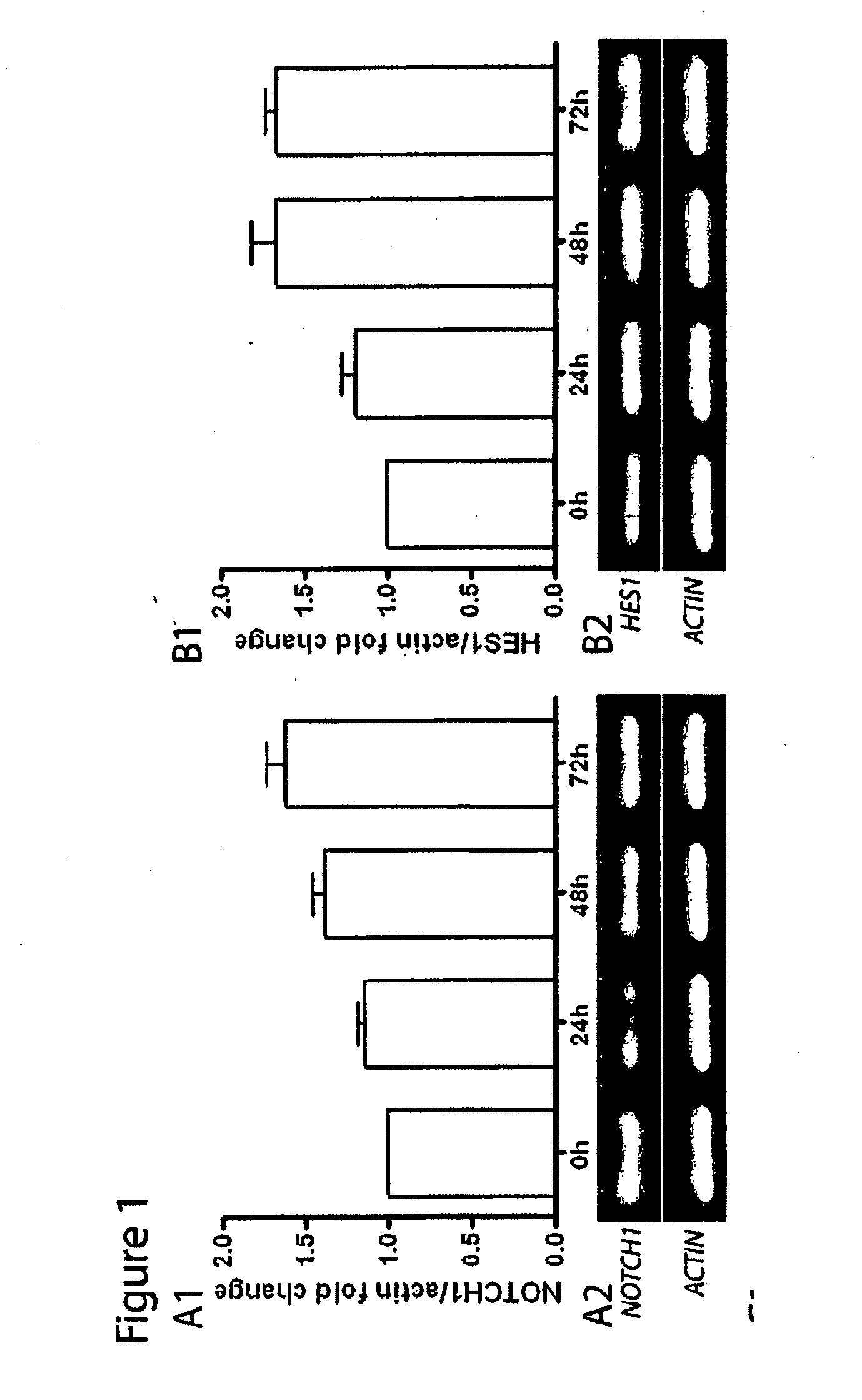 Method for generating islet beta cells from dedifferentiated exocrine pancreatic cells