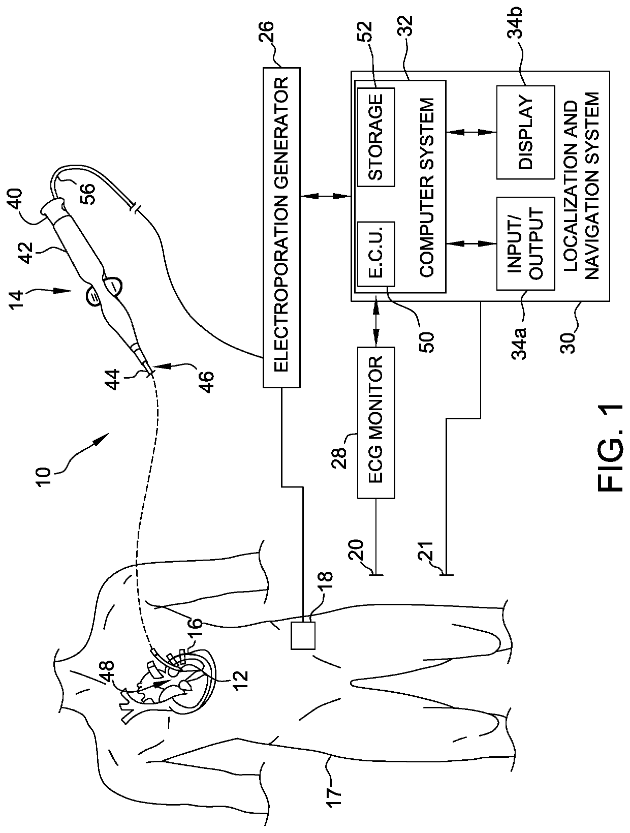 Electroporation system and method of preconditioning tissue for electroporation therapy