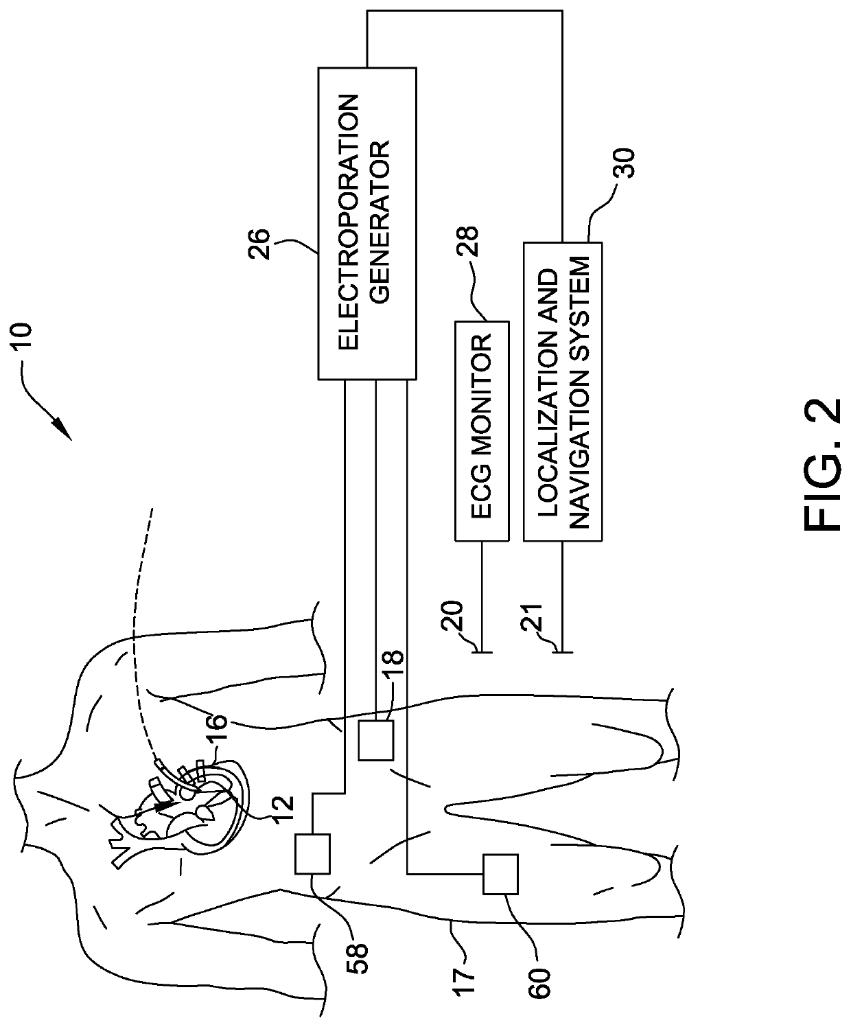 Electroporation system and method of preconditioning tissue for electroporation therapy