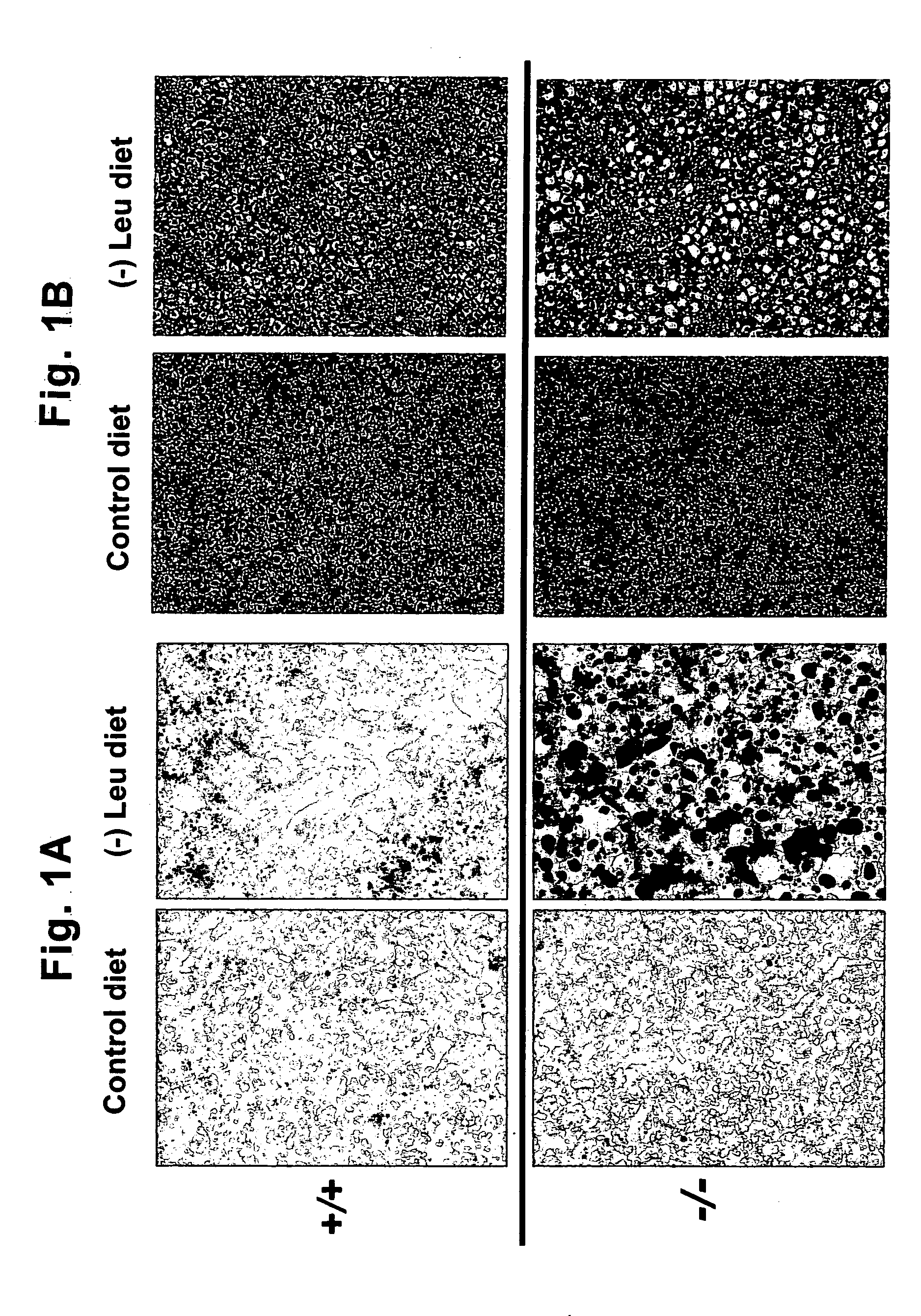 Methods for reduction of adipose tissue mass