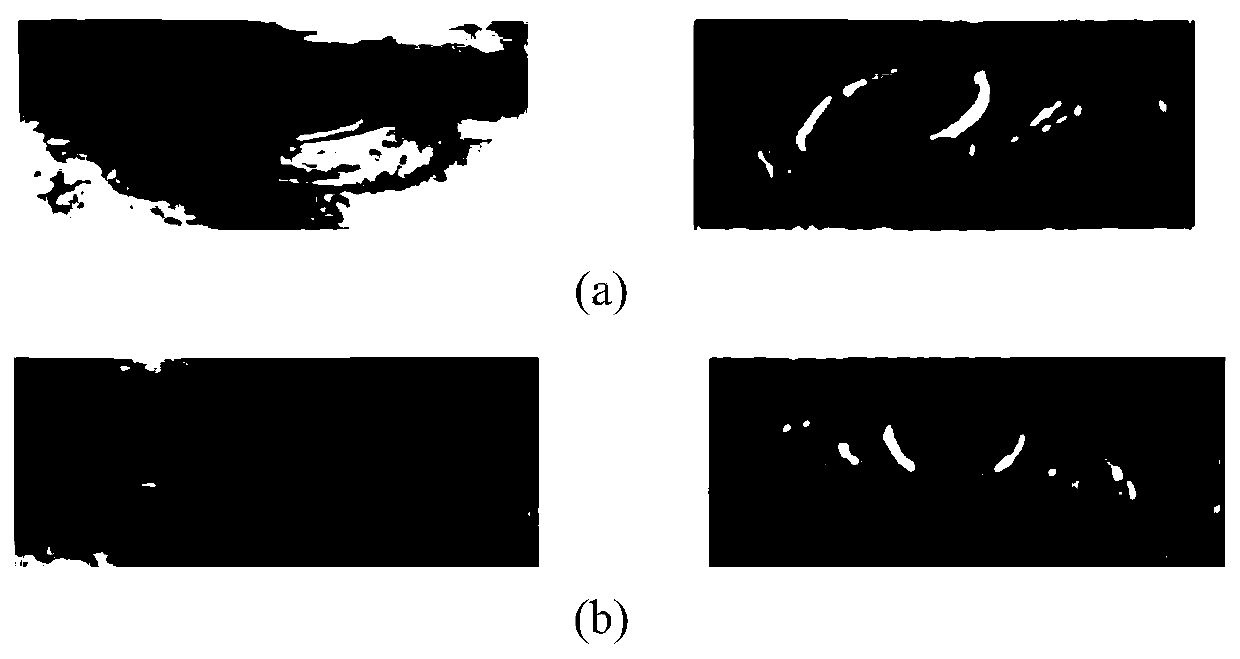 Facial paralysis grading comprehensive evaluation system combining facial textures and optical flow characteristics