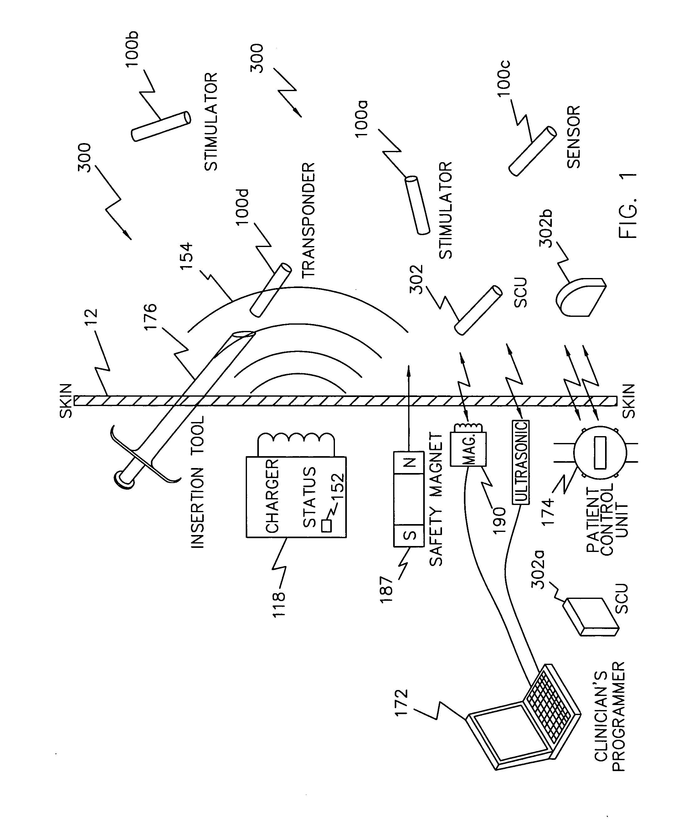 Stent having an integral ultrasonic emitter for preventing restenosis following a stent procedure