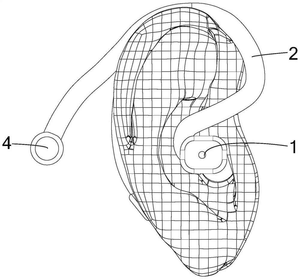 Osteoconduction hearing aid