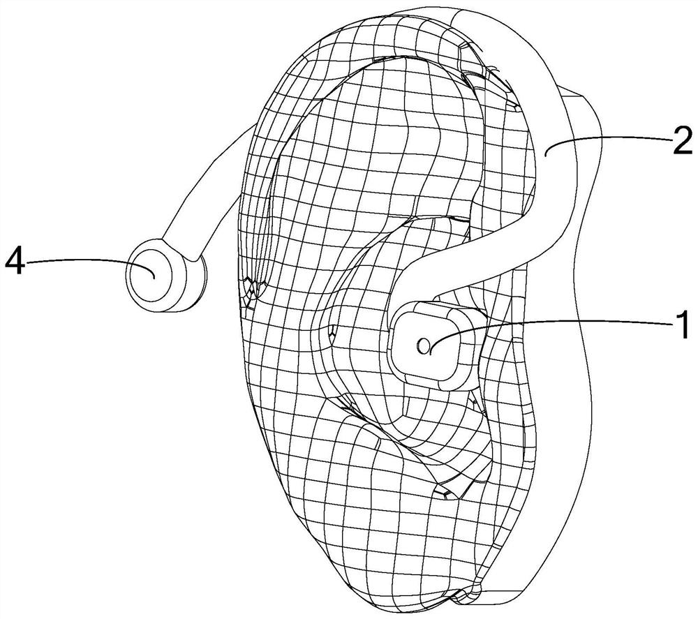 Osteoconduction hearing aid