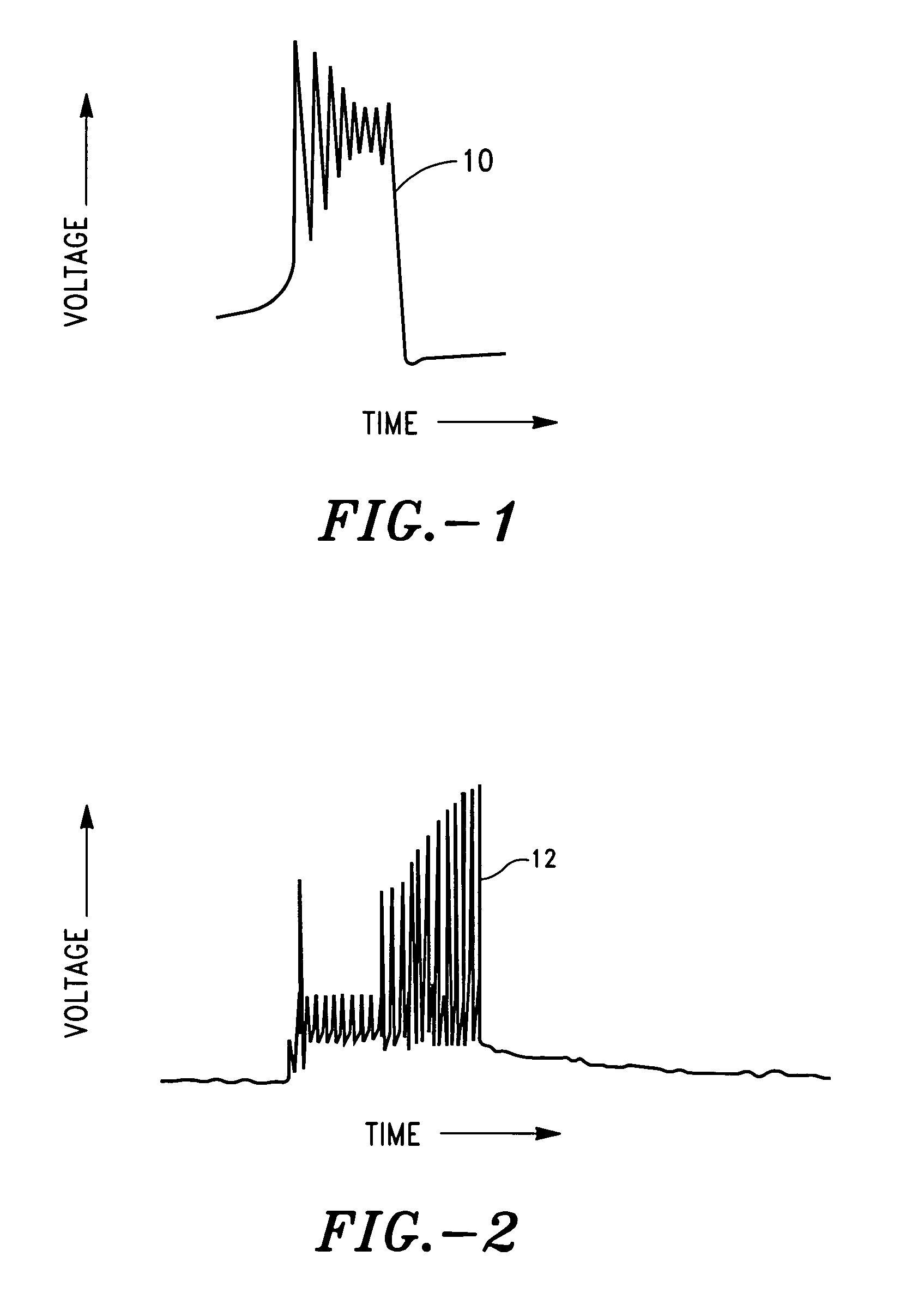 Method and system for regulation of endocrine and exocrine glands by means of neuro-electrical coded signals