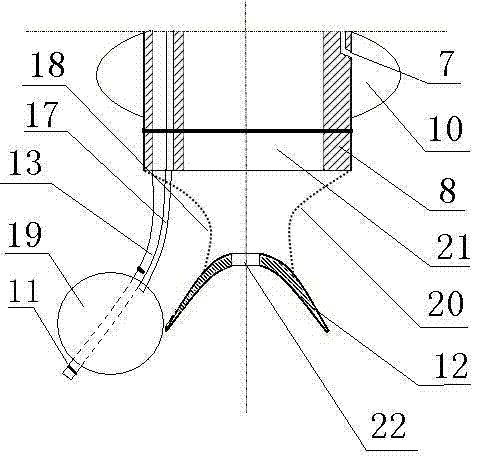 One-lung ventilation integrated device of single-cavity trachea catheter and bronchus blocking device