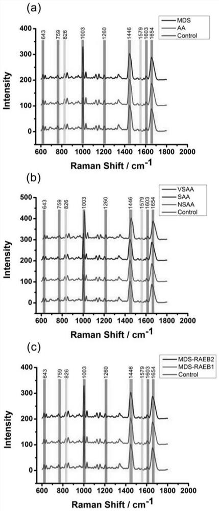 Application of serum Raman spectroscopy in rapid early identification of aplastic anemia and myelodysplastic syndrome