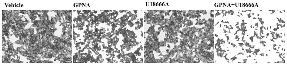 Application of cholesterol transport inhibitor U18666A as sensitizer in preparation of antitumor products