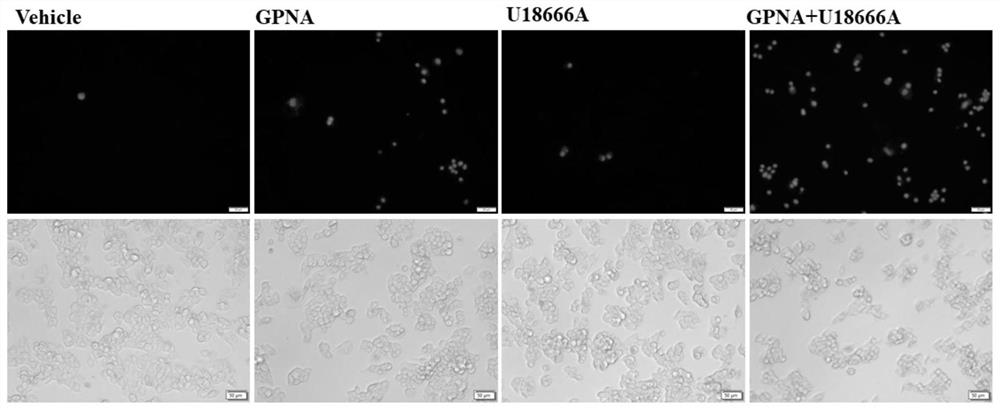 Application of cholesterol transport inhibitor U18666A as sensitizer in preparation of antitumor products
