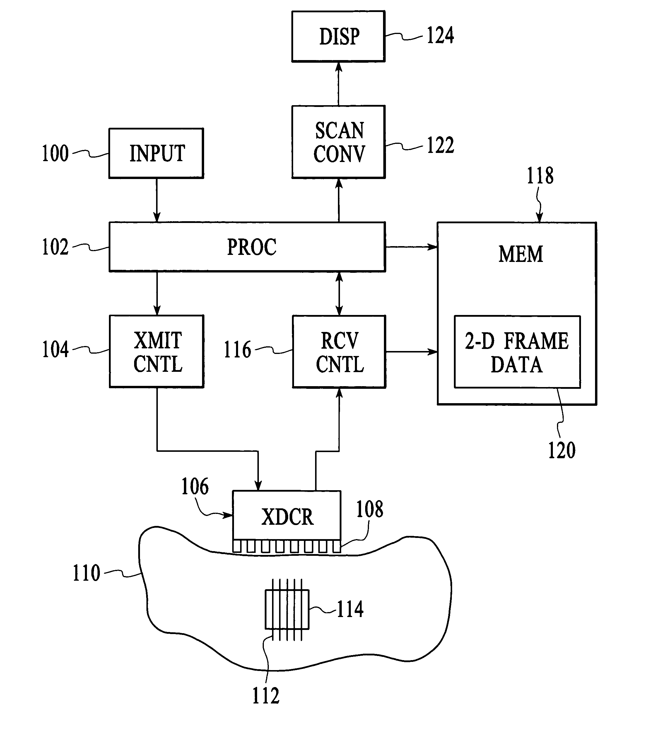 Method and system for improving the spatial resolution for strain imaging