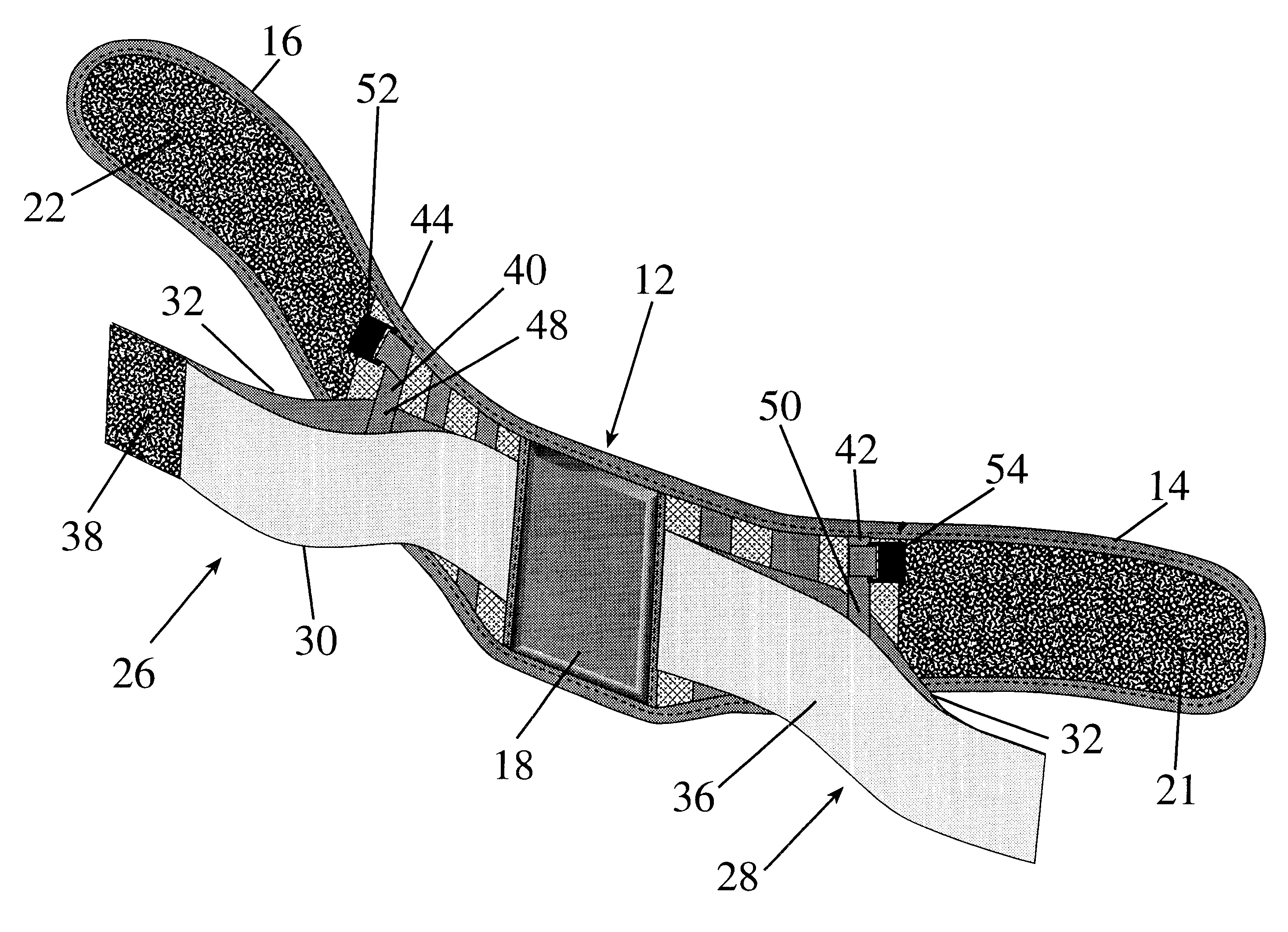 Detachable back support, apron and method