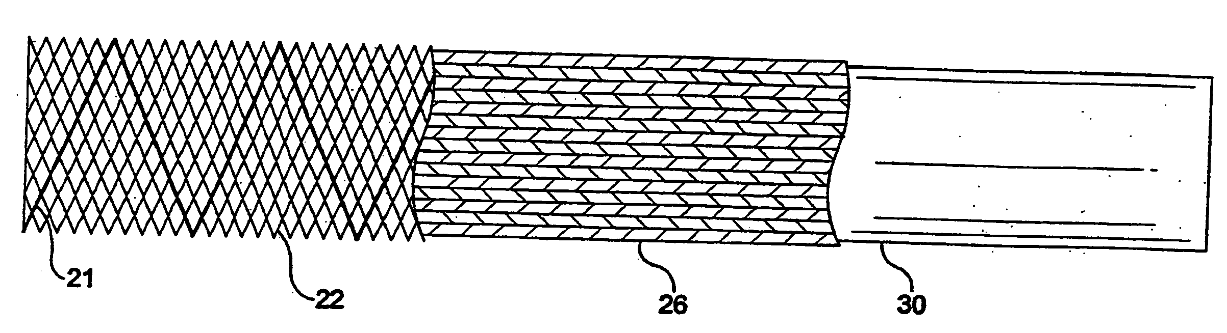 Stent-graft-membrane and method of making the same