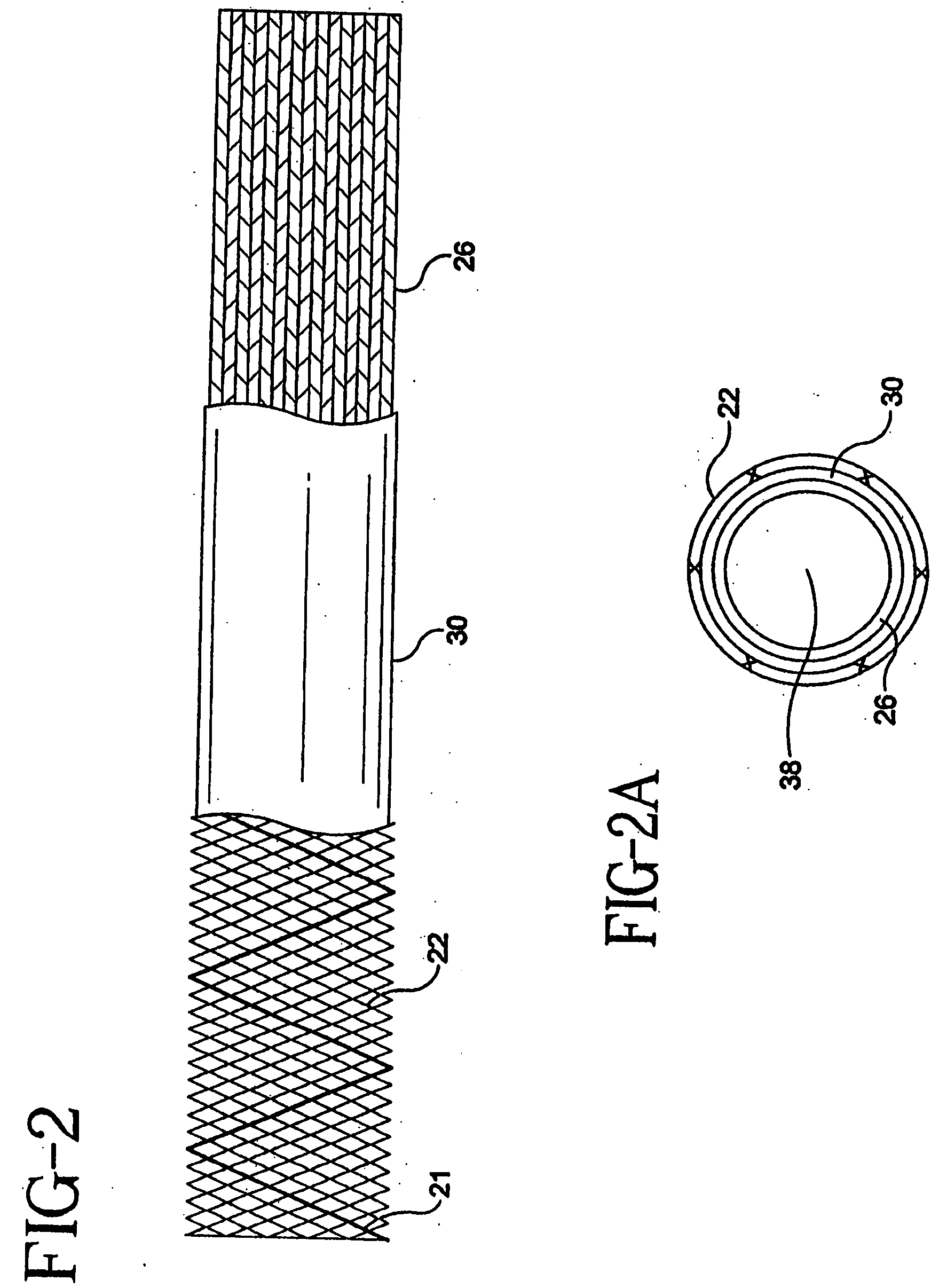 Stent-graft-membrane and method of making the same