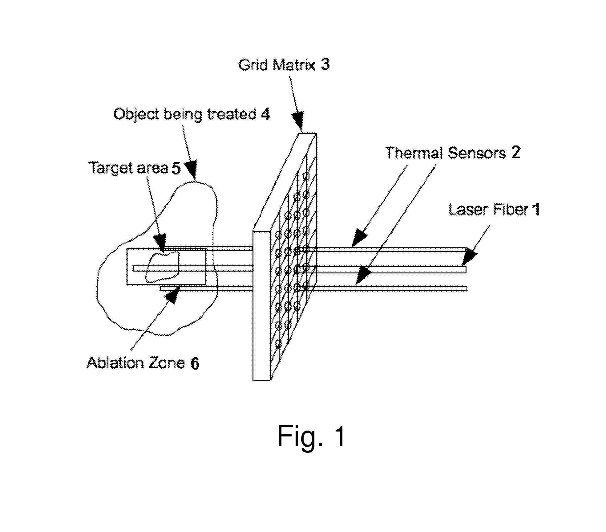 Method and apparatus for laser ablation under ultrasound guidance