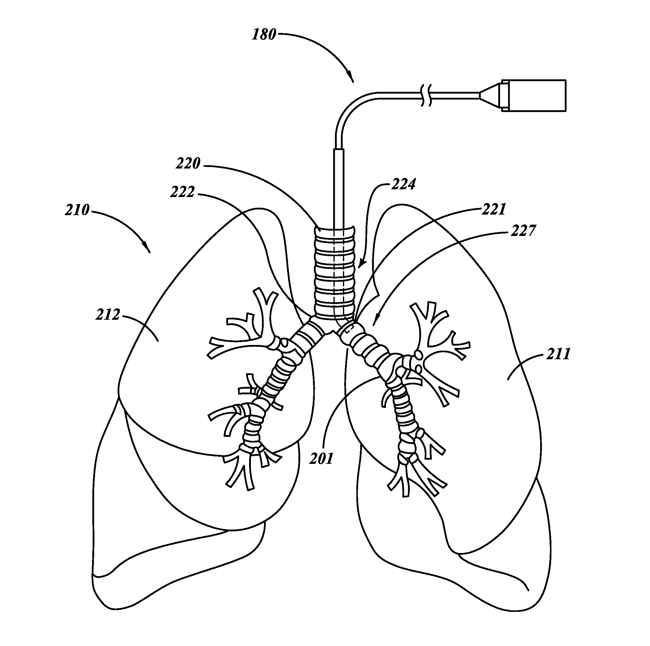 Methods and systems for screening subjects