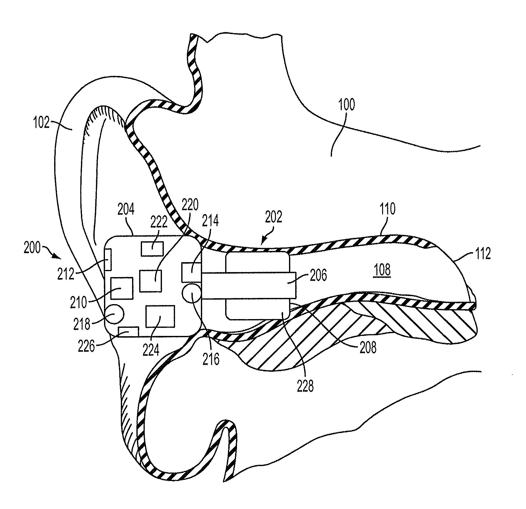 Methods and devices for occluding an ear canal having a predetermined filter characteristic