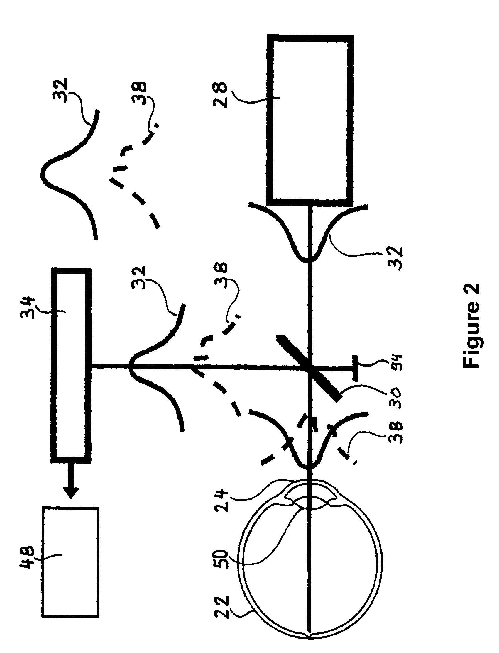 Method and an apparatus for the simultaneous determination of surface topometry and biometry of the eye