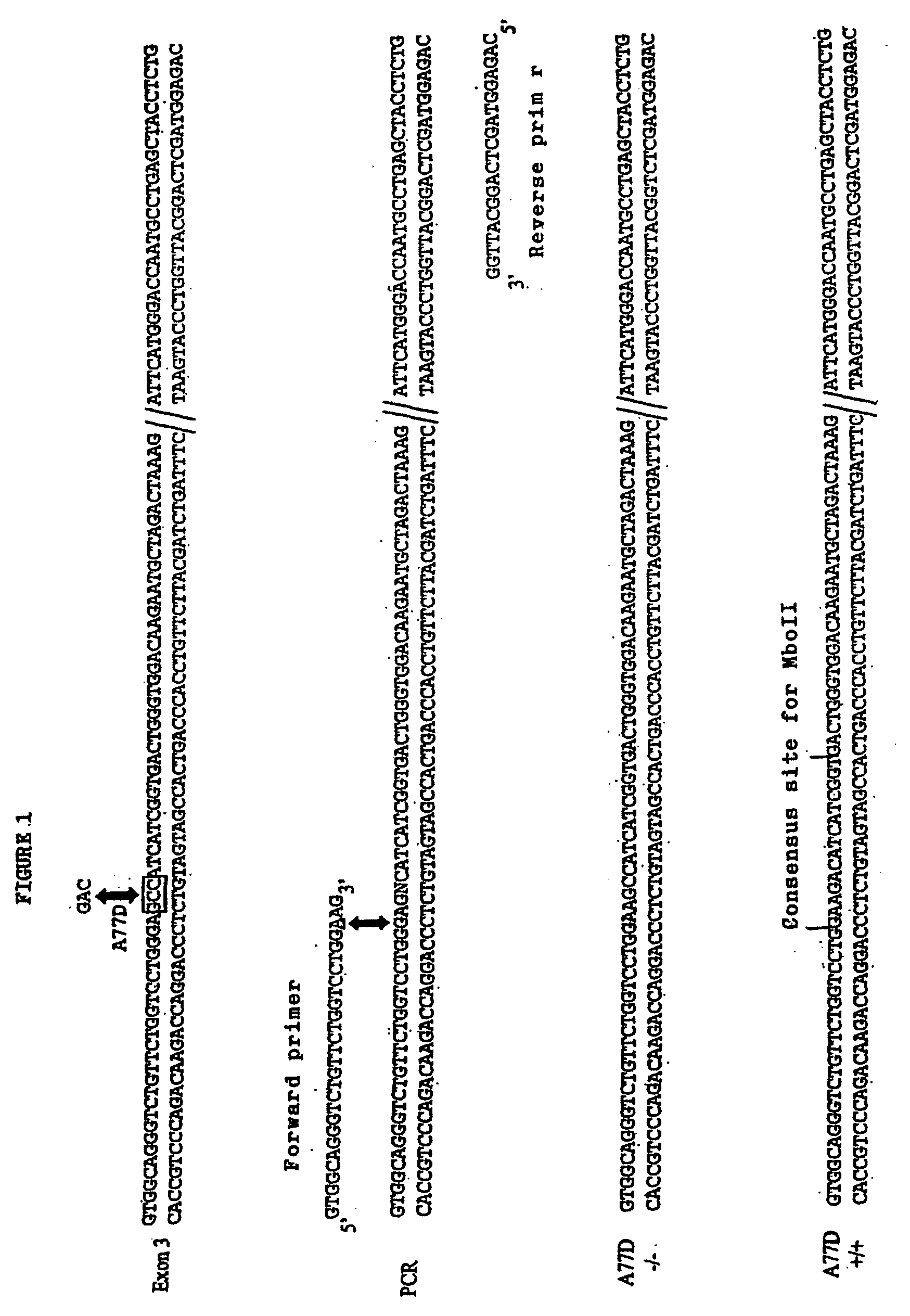 Mutations in the Ferroportin 1 Gene Associated with Hereditary Haemochromatosis