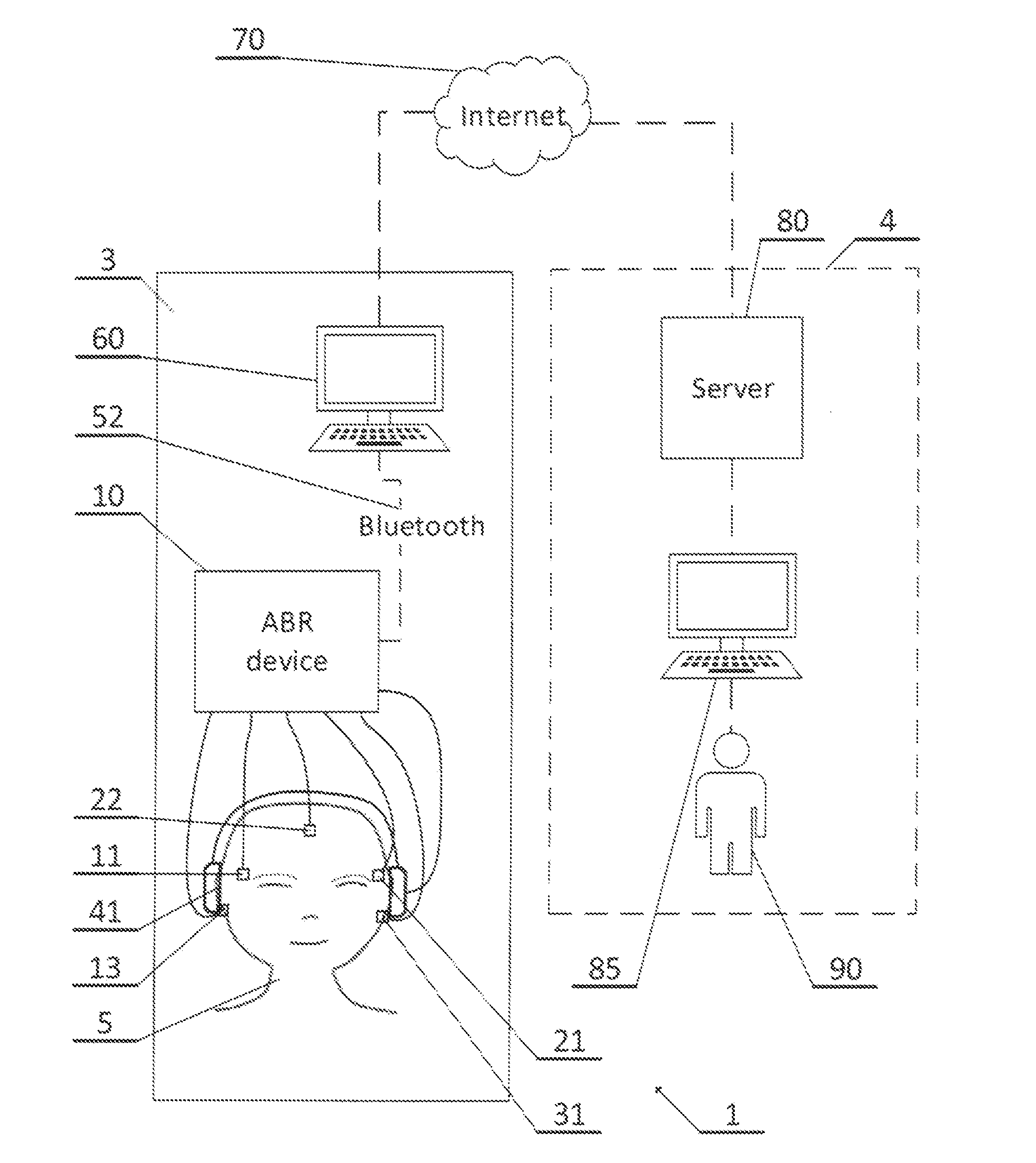 System for recording and processing signal for diagnosing auditory system and method for recording and processing signal for diagnosing auditory system