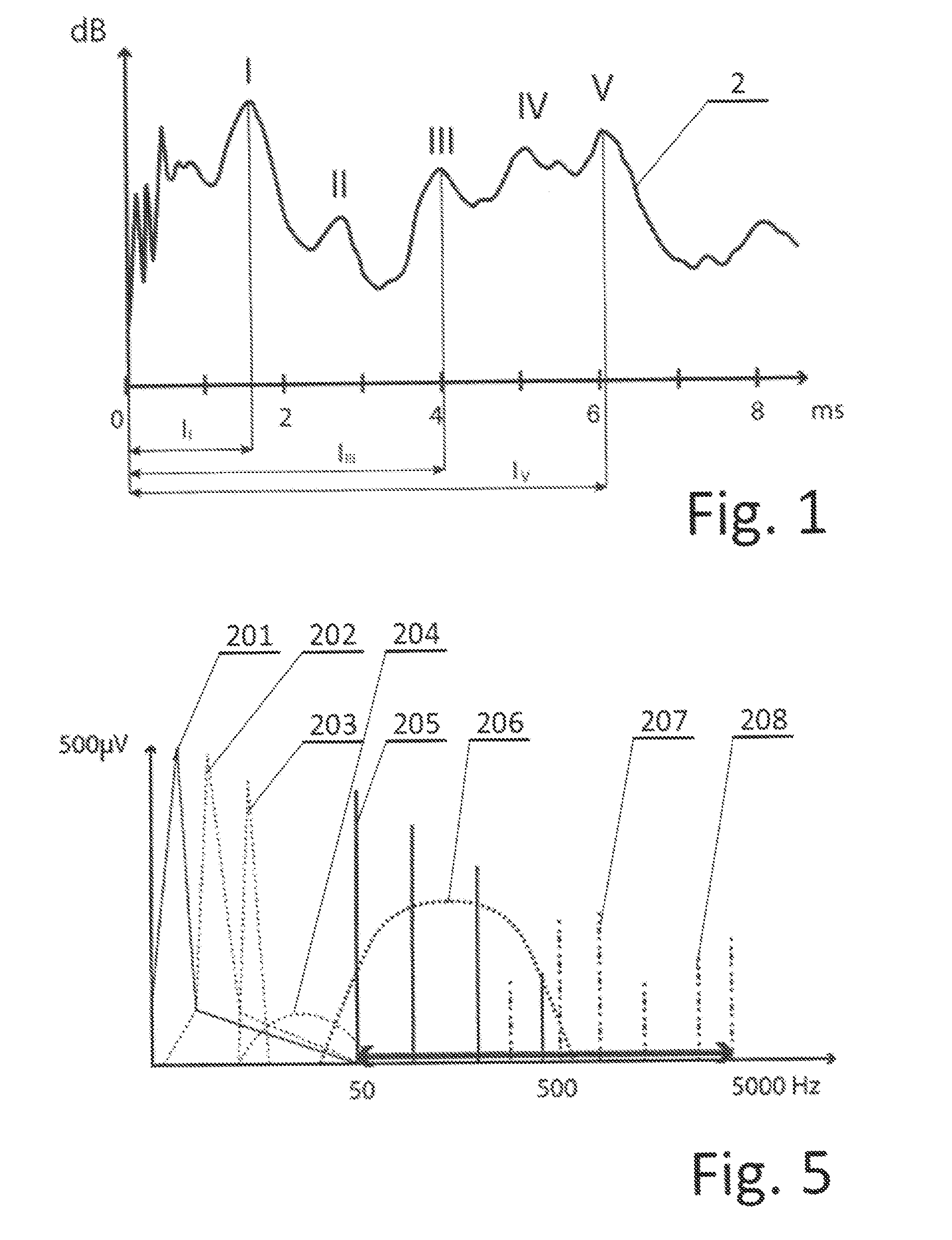 System for recording and processing signal for diagnosing auditory system and method for recording and processing signal for diagnosing auditory system