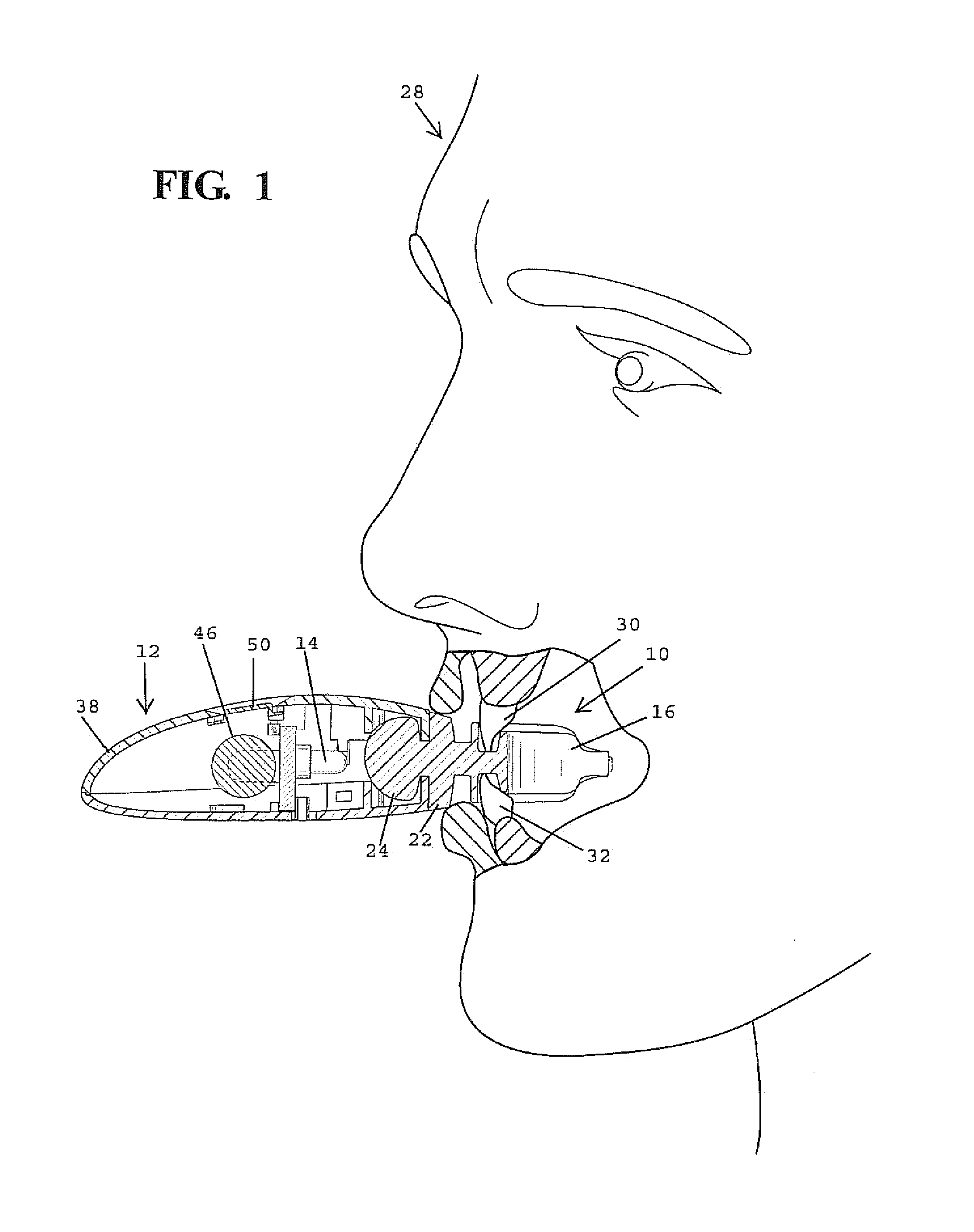 Method and apparatus for whitening teeth