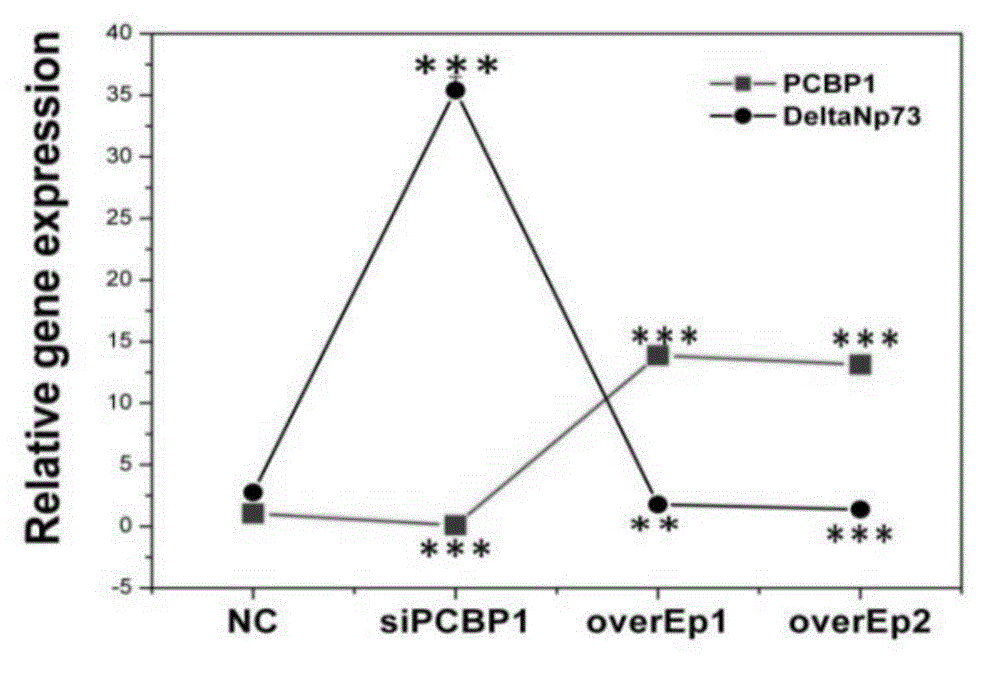 Application of PCBP1 gene in preparing radiotherapy sensitivity enhancing kit