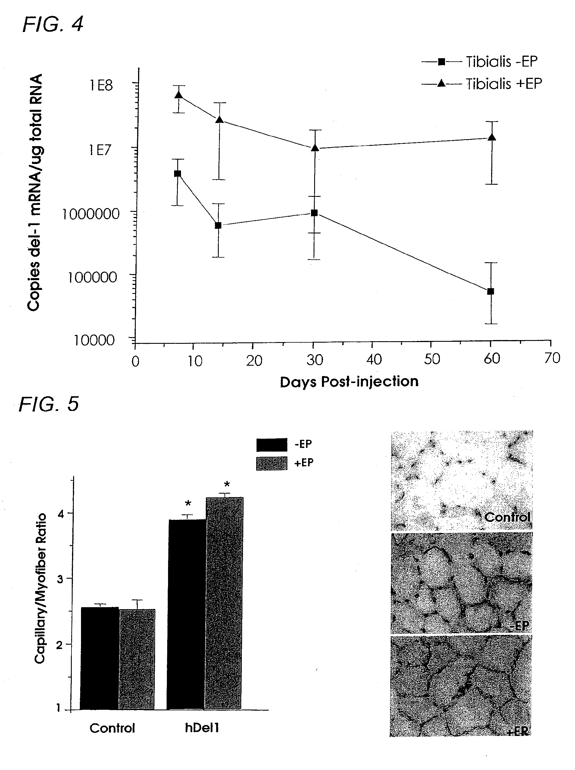 Gene delivery formulations and methods for treatment of ischemic conditions