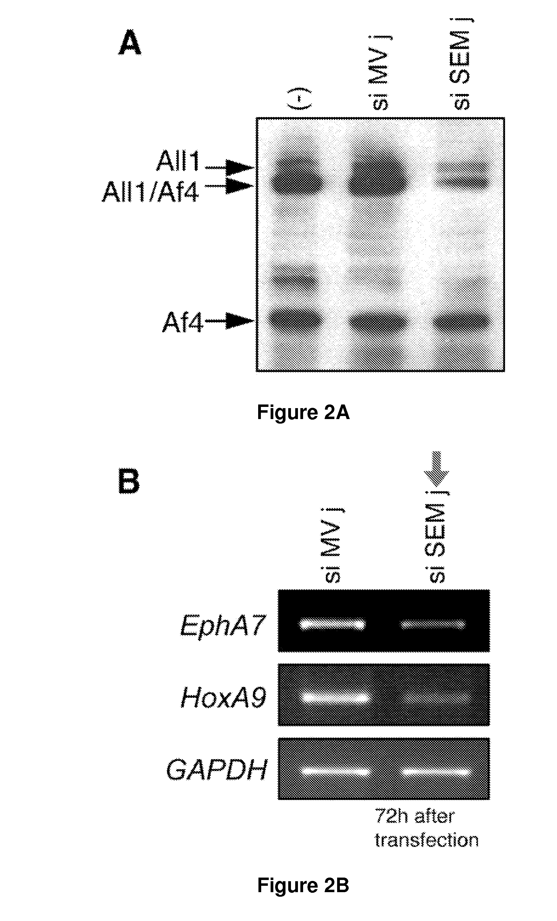 Methods and Compositions for Inducing Deregulation of EPHA7 and ERK Phosphorylation in Human Acute Leukemias