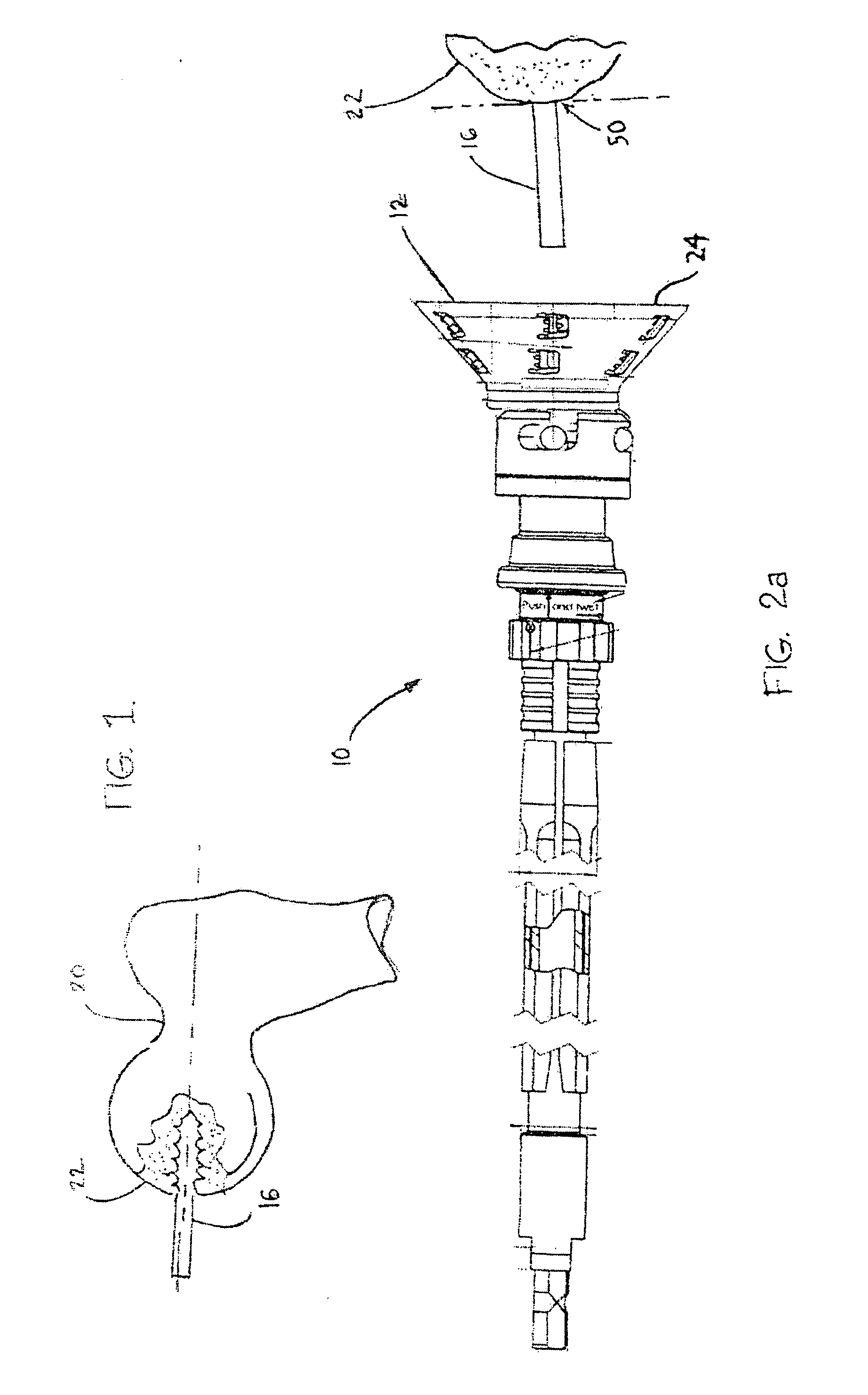 Guided reamer system for reshaping bone