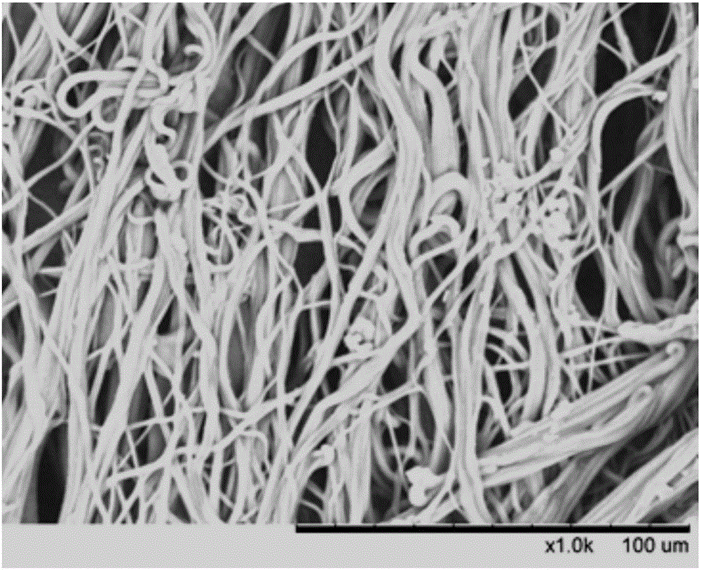 Biodegradable nano yarn capable of inhibiting fibrosis, and preparation and application thereof