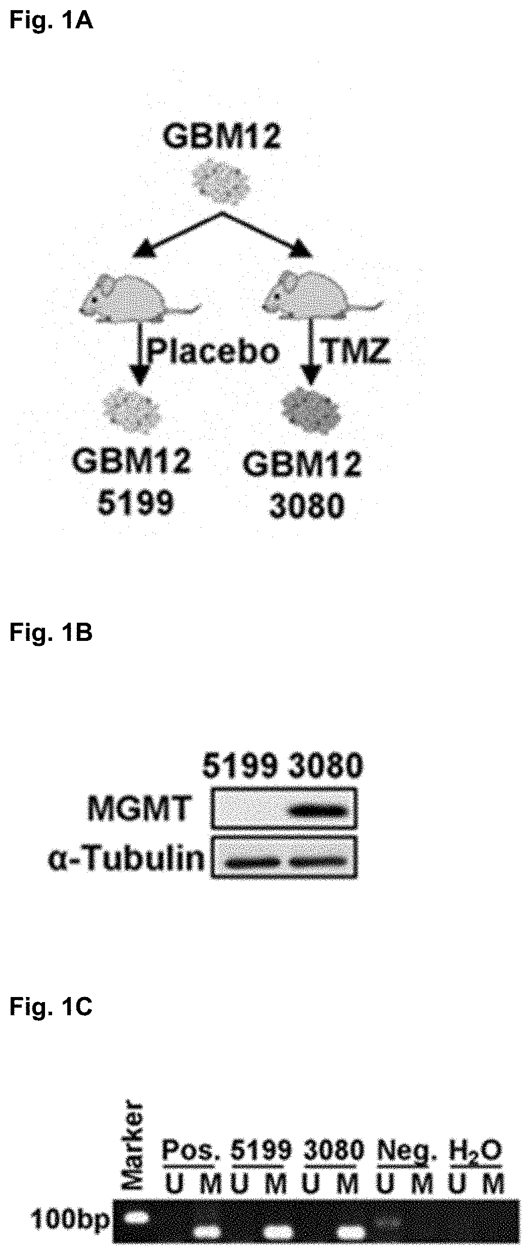 Compositions and methods for treating glioblastoma by modulating a mgmt enhancer
