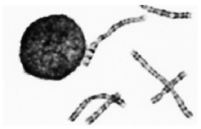Chromosome segmentation method and device