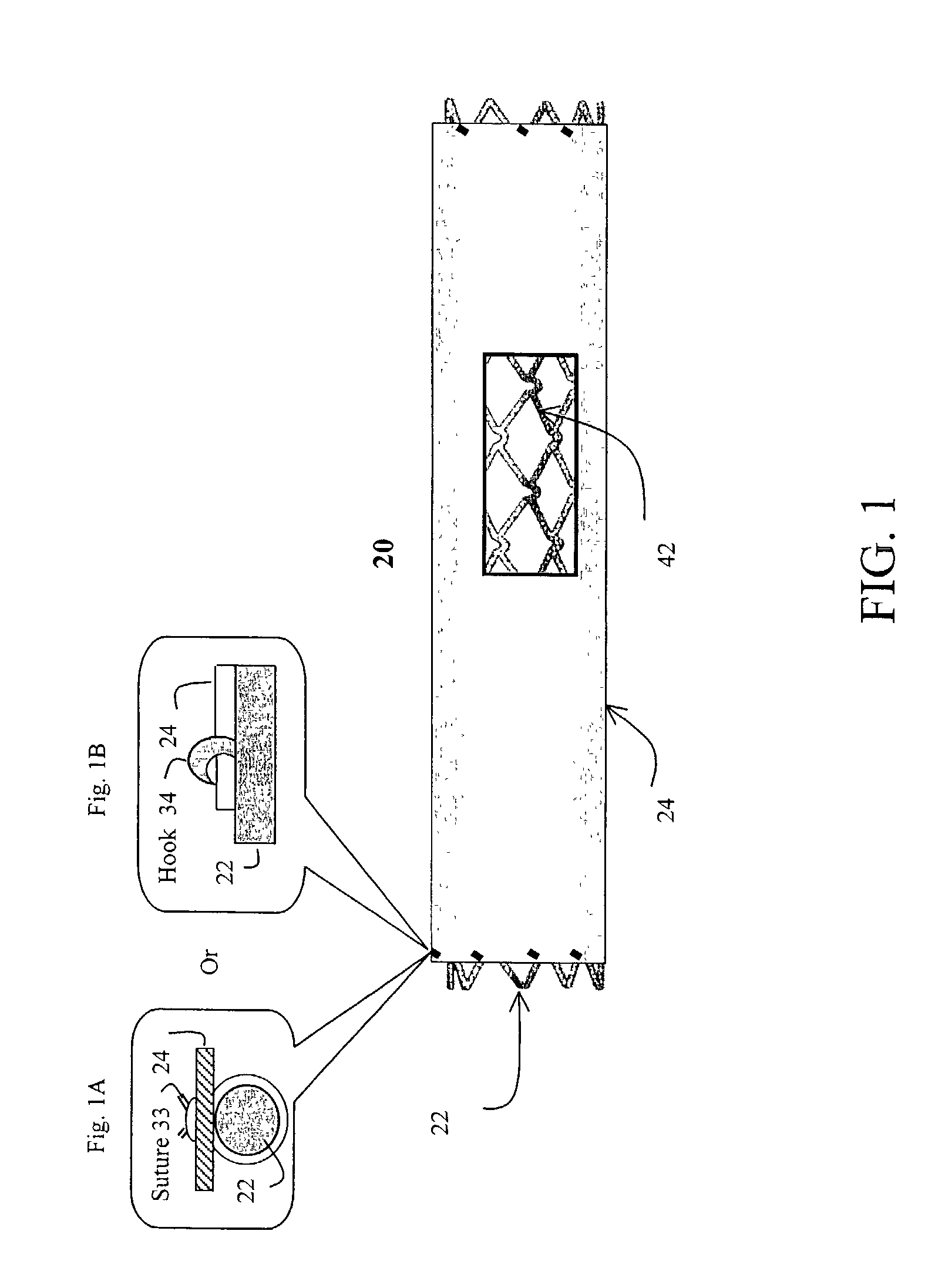 Stent having cover with drug delivery capability