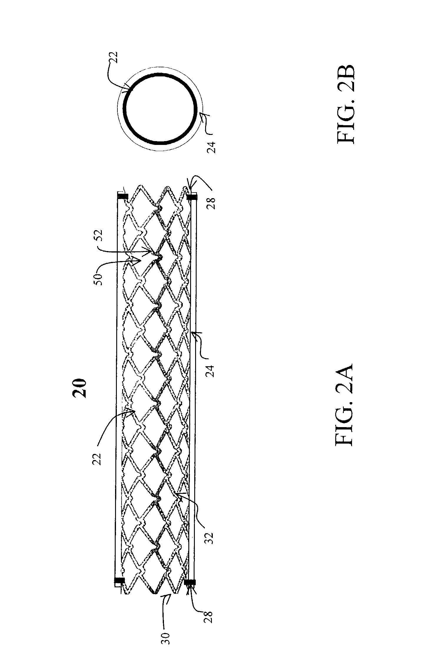 Stent having cover with drug delivery capability