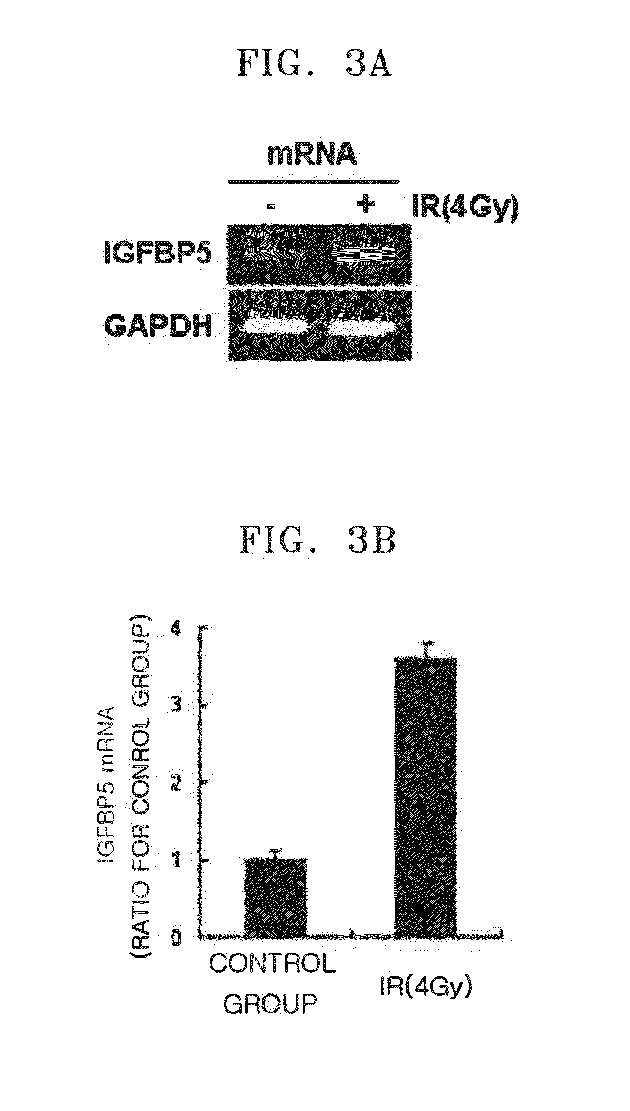 Radiation exposure diagnostic marker igfbp-5, composition for radiation exposure diagnosis by measuring the expression level of the marker, radiation exposure diagnostic kit comprising the composition, and method for diagnosing radiation exposure using the marker