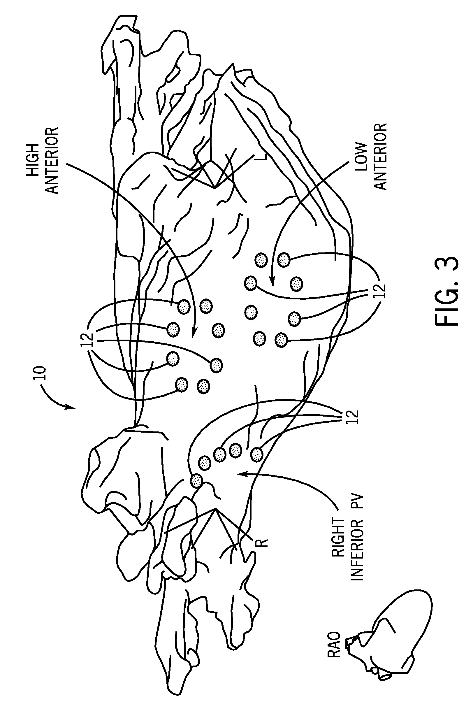 System and method for assessing atrial electrical stability